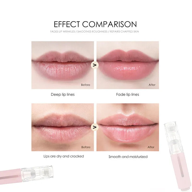 Lip Serum Kit with Micro-Needle Tool | Gorgeousgardenskin