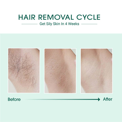 IPL Hair Removal Device | Gorgeousgardenskin