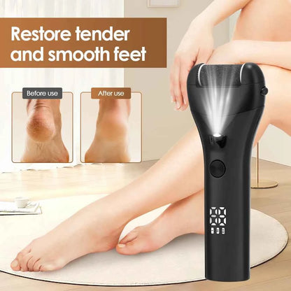 Silky Feet Electric Foot Grinder: Experience Spa-Quality Pedicures at Home
